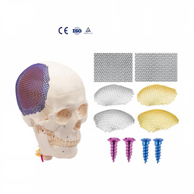 Anatomical Cloud Shape Orthopedic Implant Plate and Screw Cranial Titanium Mesh Manual Power Source