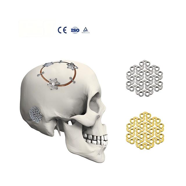 Medical Factory Supply Mini Skull Titanium Mesh Forehead Bone Plates Manual Cranial Titanium Mini Forehead Bone Plate